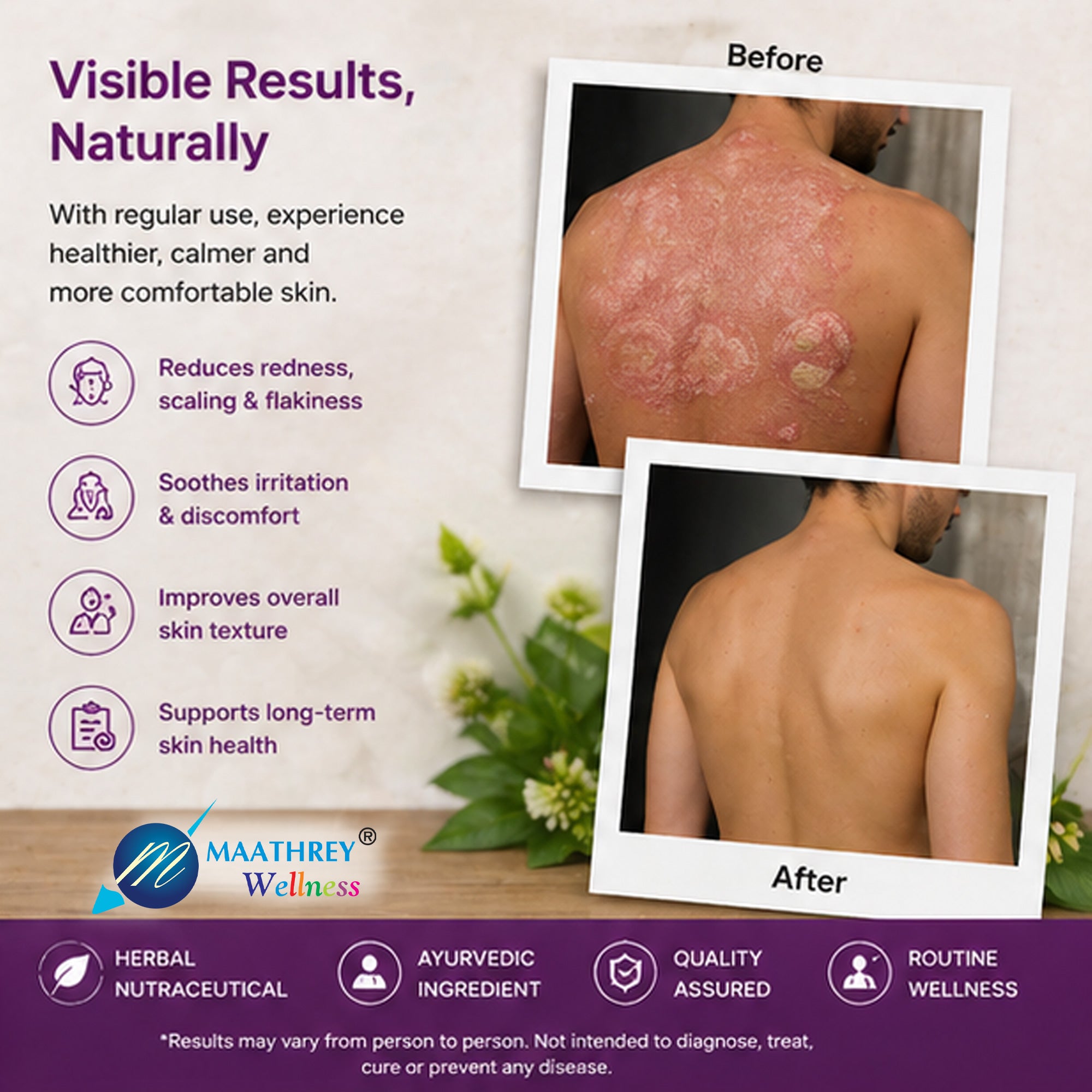 Sorfar Sphaeranthus Indicus Tablets – For Skin Health Support